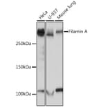 Western Blot - Anti-Filamin A Antibody [ARC0242] (A305952) - Antibodies.com