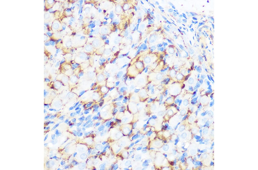 Immunohistochemistry - Anti-Filamin A Antibody [ARC0242] (A305952) - Antibodies.com