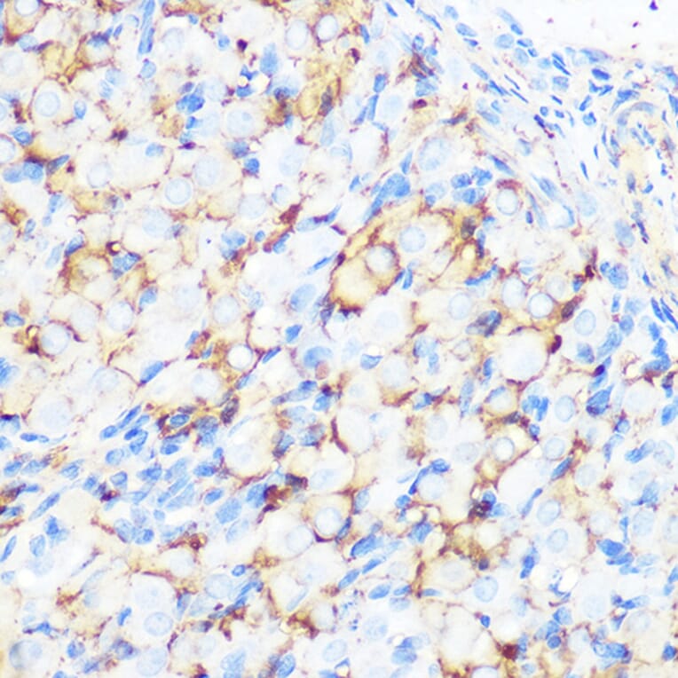 Immunohistochemistry - Anti-Filamin A Antibody [ARC0242] (A305952) - Antibodies.com