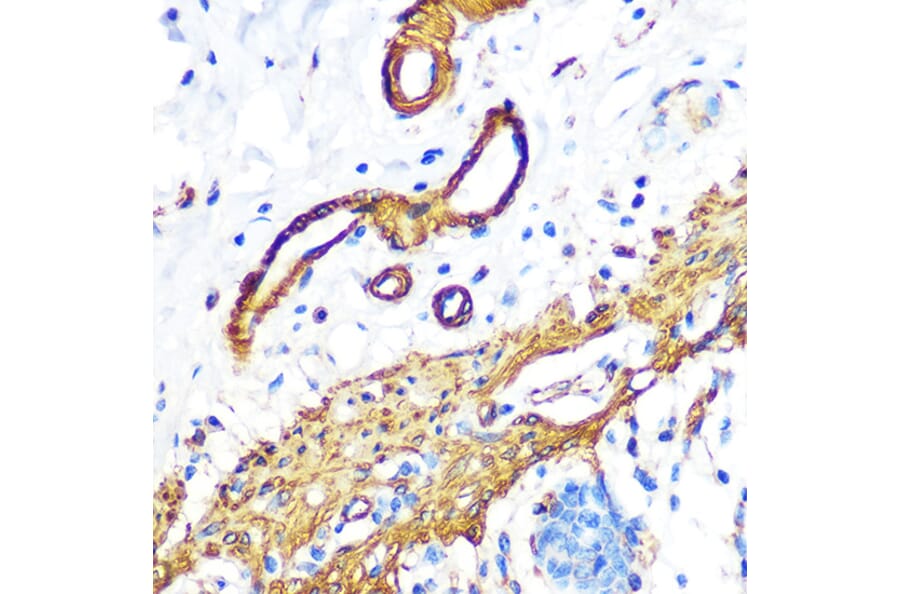 Immunohistochemistry - Anti-Filamin A Antibody [ARC0242] (A305952) - Antibodies.com