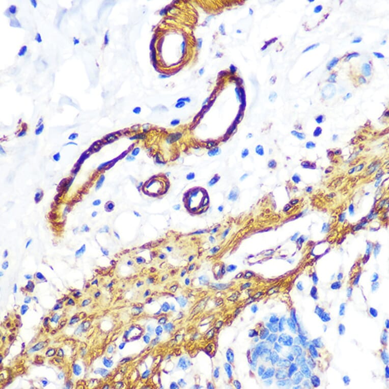 Immunohistochemistry - Anti-Filamin A Antibody [ARC0242] (A305952) - Antibodies.com