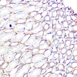 Immunohistochemistry - Anti-Filamin A Antibody [ARC0242] (A305952) - Antibodies.com