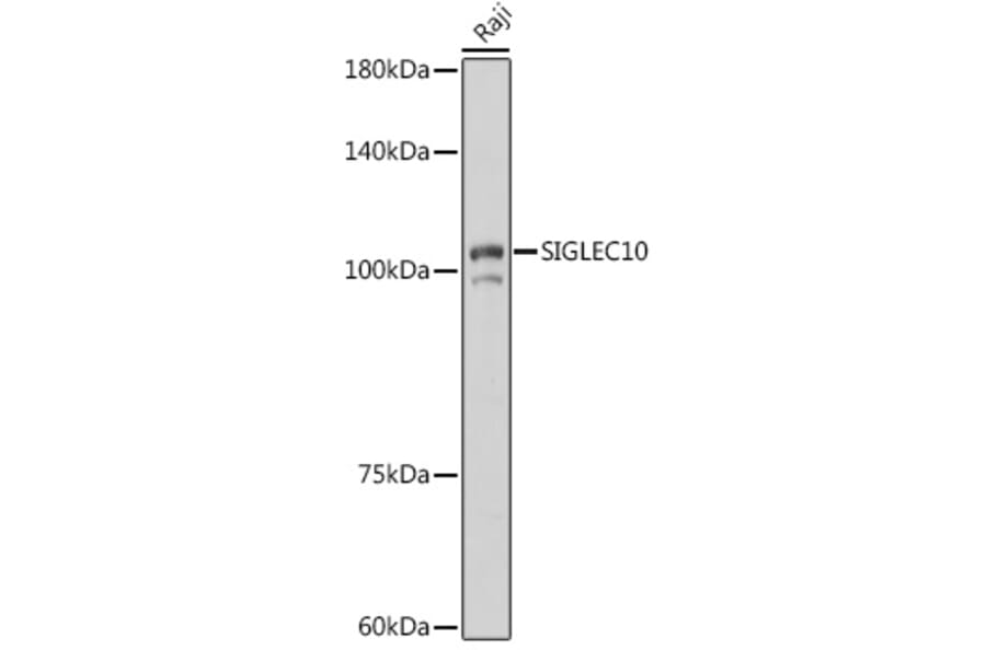 Western Blot - Anti-SIGLEC10 Antibody (A305953) - Antibodies.com