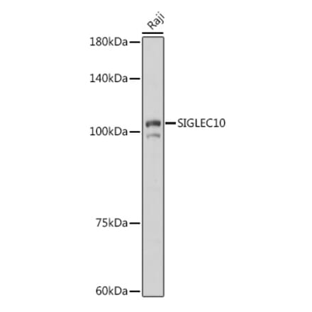 Western Blot - Anti-SIGLEC10 Antibody (A305953) - Antibodies.com