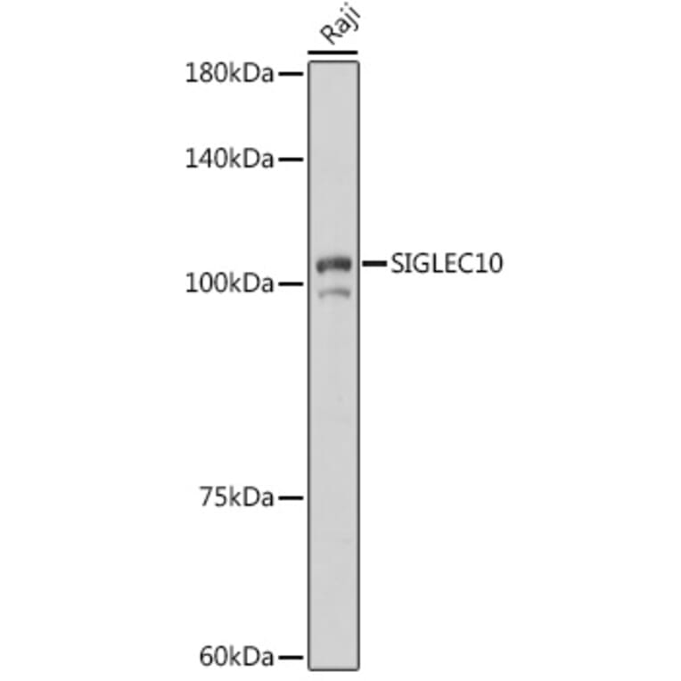 Western Blot - Anti-SIGLEC10 Antibody (A305953) - Antibodies.com