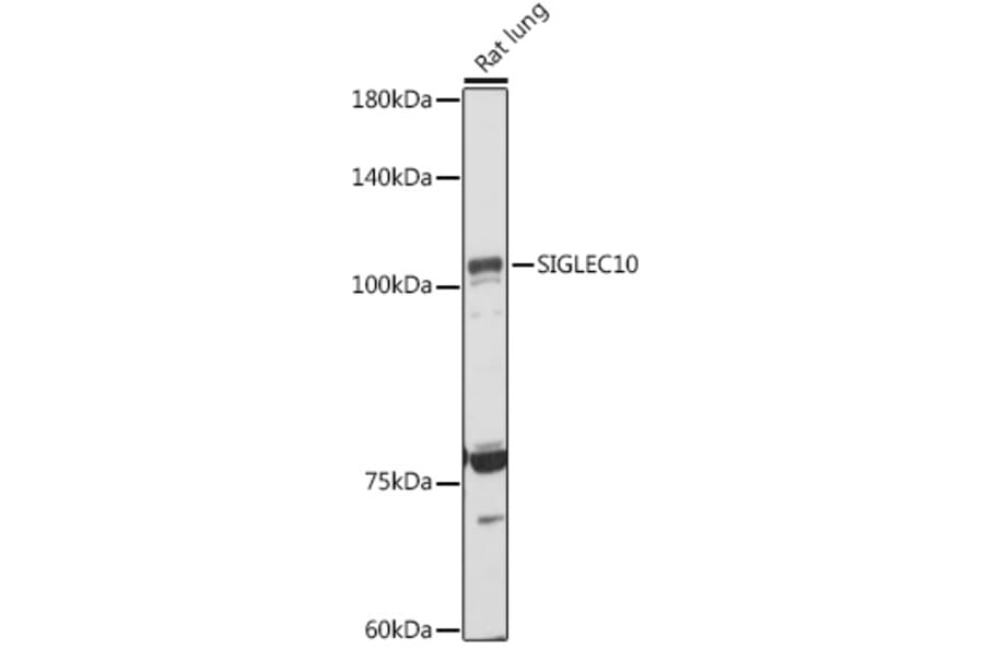 Western Blot - Anti-SIGLEC10 Antibody (A305953) - Antibodies.com