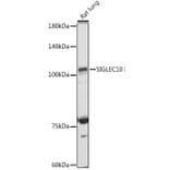 Western Blot - Anti-SIGLEC10 Antibody (A305953) - Antibodies.com