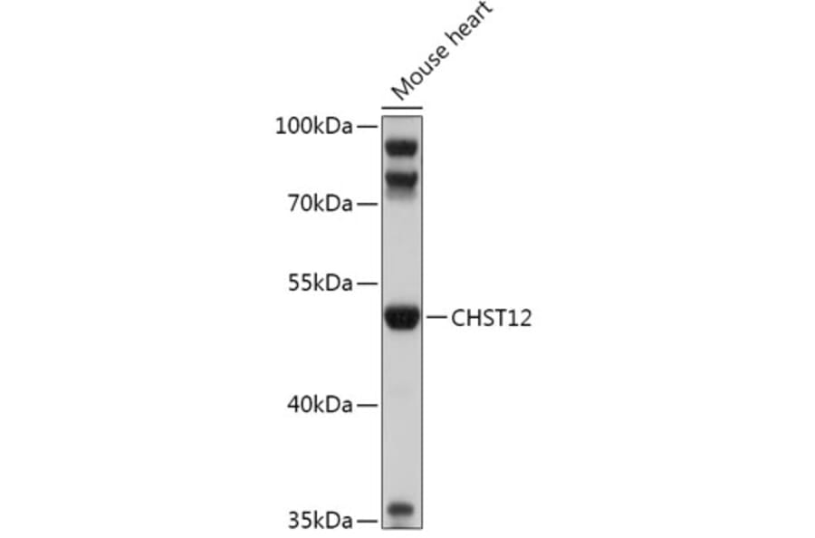 Western Blot - Anti-CHST12 Antibody (A305954) - Antibodies.com