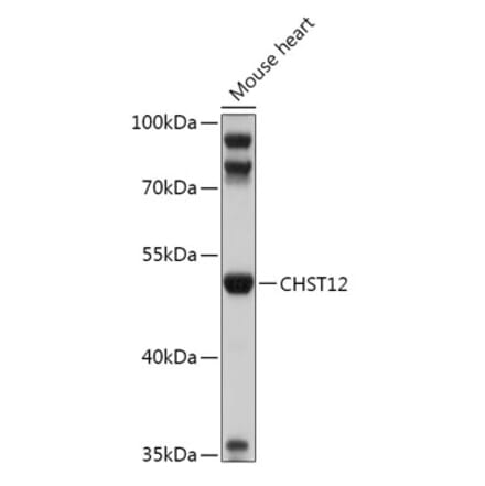 Western Blot - Anti-CHST12 Antibody (A305954) - Antibodies.com