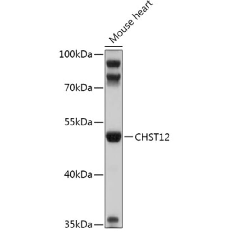 Western Blot - Anti-CHST12 Antibody (A305954) - Antibodies.com