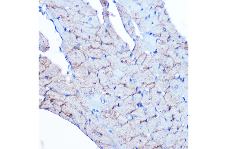 Immunohistochemistry - Anti-Flotillin 1 Antibody [ARC0765] (A305955) - Antibodies.com