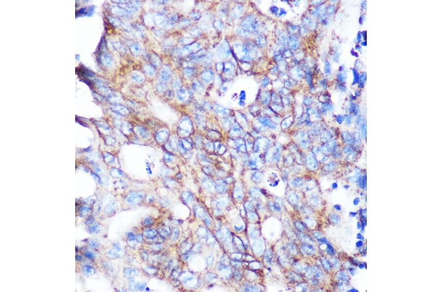 Immunohistochemistry - Anti-Flotillin 1 Antibody [ARC0765] (A305955) - Antibodies.com