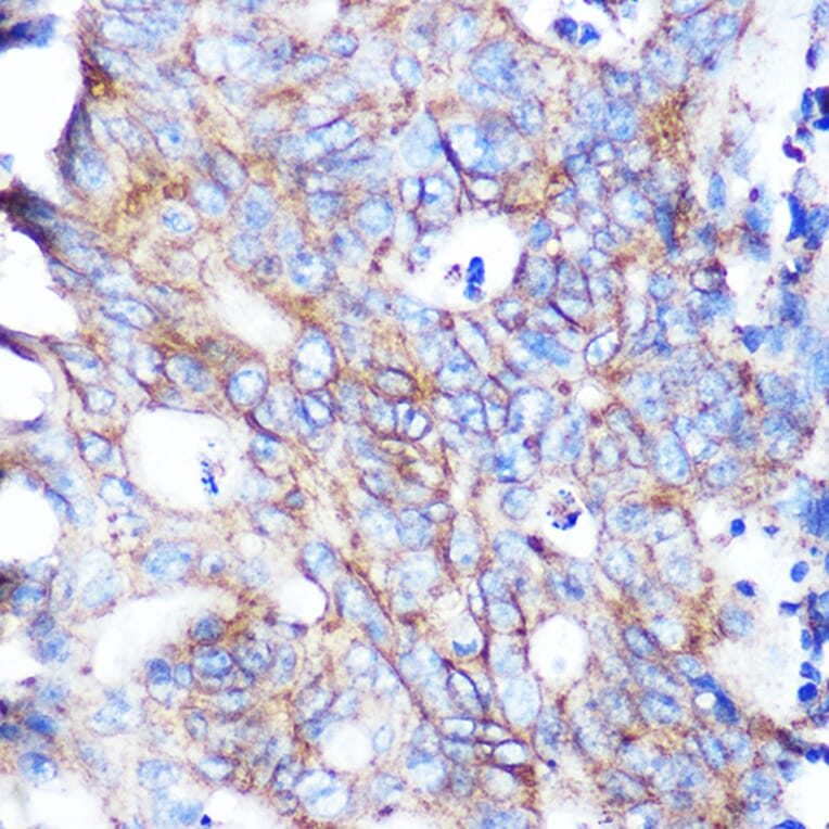 Immunohistochemistry - Anti-Flotillin 1 Antibody [ARC0765] (A305955) - Antibodies.com