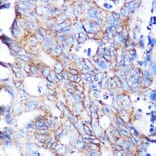 Immunohistochemistry - Anti-Flotillin 1 Antibody [ARC0765] (A305955) - Antibodies.com
