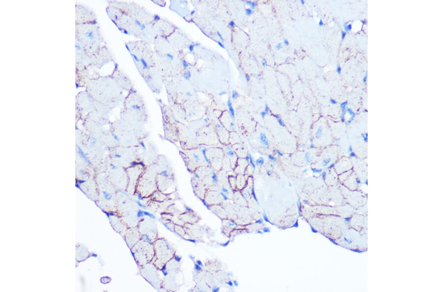Immunohistochemistry - Anti-Flotillin 1 Antibody [ARC0765] (A305955) - Antibodies.com
