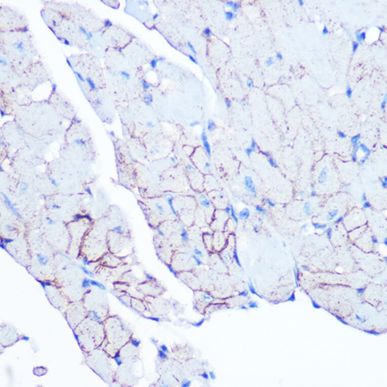 Immunohistochemistry - Anti-Flotillin 1 Antibody [ARC0765] (A305955) - Antibodies.com