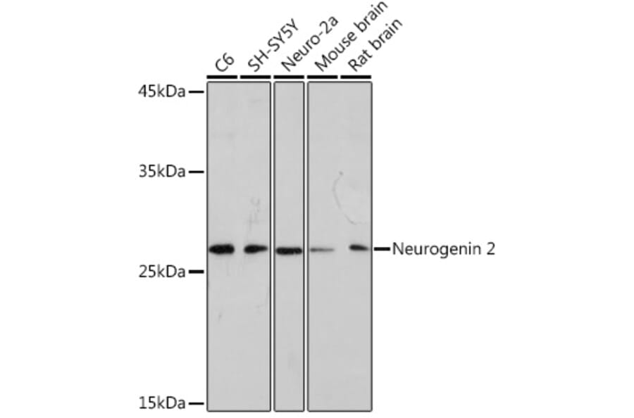 Western Blot - Anti-Neurogenin 2/NGN2 Antibody [ARC2326] (A305957) - Antibodies.com