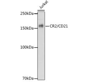Western Blot - Anti-CD21 Antibody [ARC1868] (A305959) - Antibodies.com