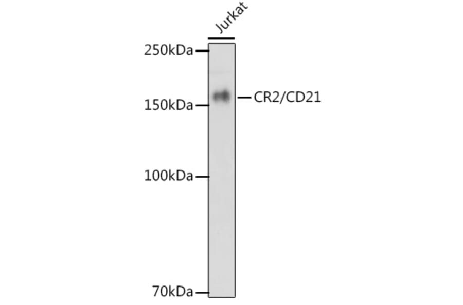 Western Blot - Anti-CD21 Antibody [ARC1868] (A305959) - Antibodies.com