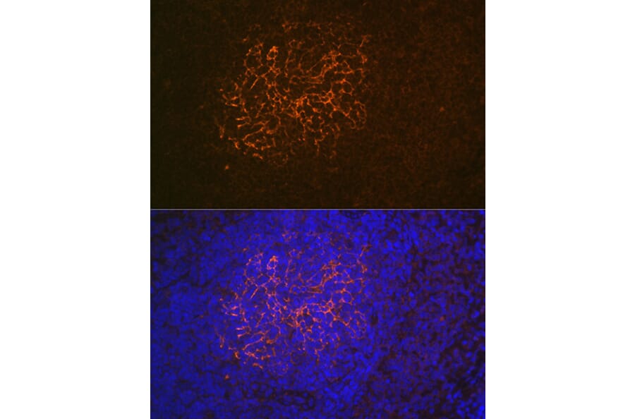 Immunohistochemistry - Anti-CD21 Antibody [ARC1868] (A305959) - Antibodies.com