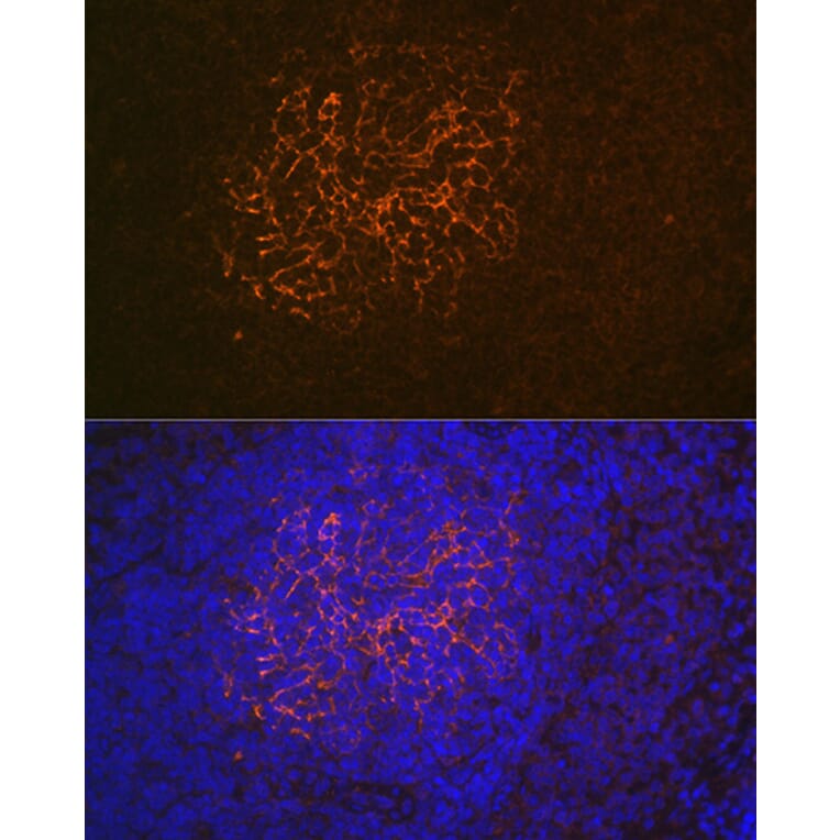 Immunohistochemistry - Anti-CD21 Antibody [ARC1868] (A305959) - Antibodies.com