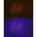 Immunohistochemistry - Anti-CD21 Antibody [ARC1868] (A305959) - Antibodies.com