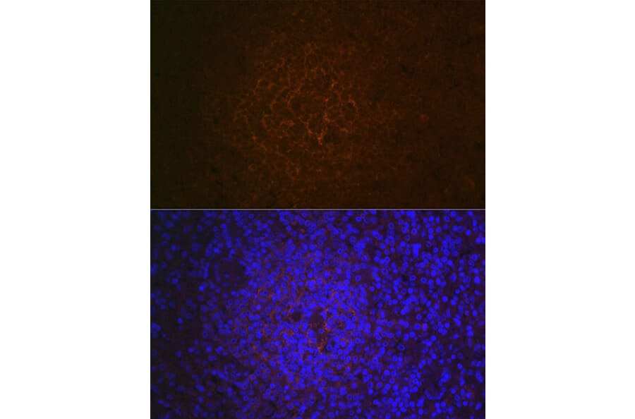 Immunohistochemistry - Anti-CD21 Antibody [ARC1868] (A305959) - Antibodies.com