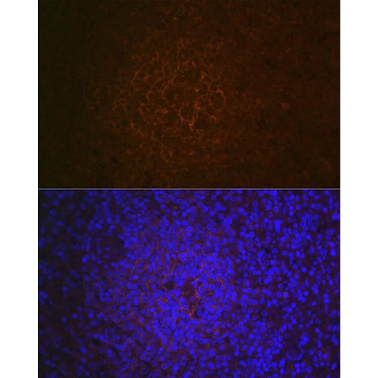 Immunohistochemistry - Anti-CD21 Antibody [ARC1868] (A305959) - Antibodies.com