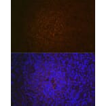 Immunohistochemistry - Anti-CD21 Antibody [ARC1868] (A305959) - Antibodies.com