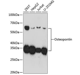 Western Blot - Anti-Osteopontin Antibody [ARC0471] (A305960) - Antibodies.com