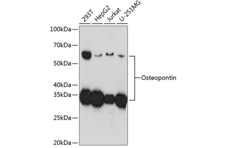 Western Blot - Anti-Osteopontin Antibody [ARC0471] (A305960) - Antibodies.com
