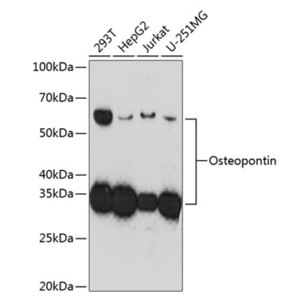 Western Blot - Anti-Osteopontin Antibody [ARC0471] (A305960) - Antibodies.com