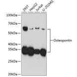 Western Blot - Anti-Osteopontin Antibody [ARC0471] (A305960) - Antibodies.com