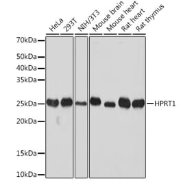 Western Blot - Anti-HPRT Antibody [ARC1300] (A305963) - Antibodies.com