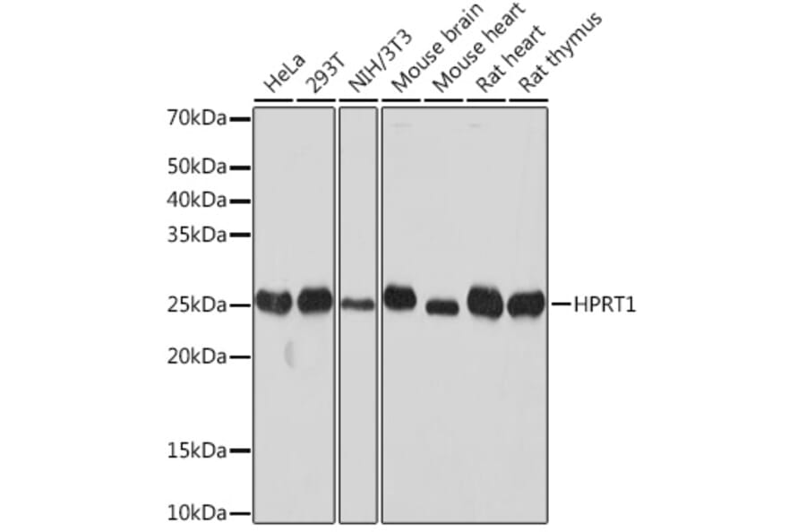 Western Blot - Anti-HPRT Antibody [ARC1300] (A305963) - Antibodies.com