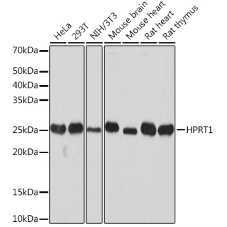 Western Blot - Anti-HPRT Antibody [ARC1300] (A305963) - Antibodies.com