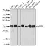 Western Blot - Anti-HPRT Antibody [ARC1300] (A305963) - Antibodies.com