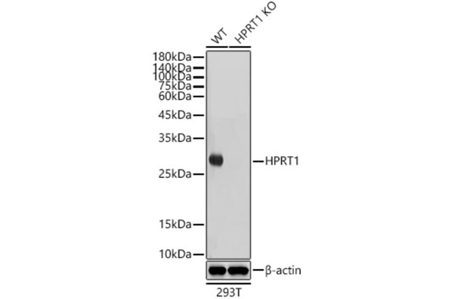 Western Blot - Anti-HPRT Antibody [ARC1300] (A305963) - Antibodies.com