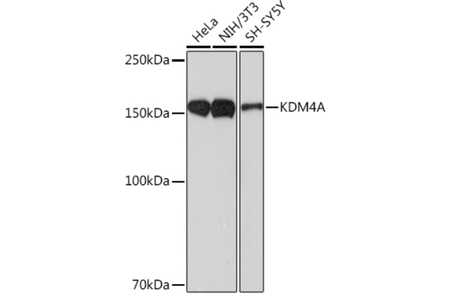 Western Blot - Anti-KDM4A/JHDM3A/JMJD2A Antibody [ARC1503] (A305964) - Antibodies.com