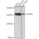 Western Blot - Anti-KDM4A/JHDM3A/JMJD2A Antibody [ARC1503] (A305964) - Antibodies.com