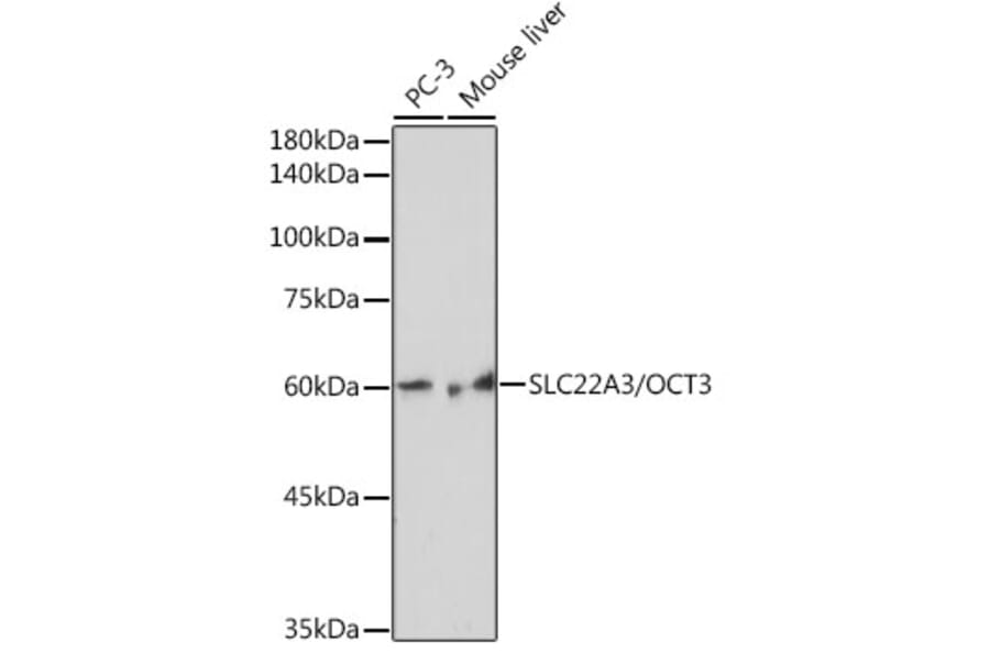 Western Blot - Anti-SLC22A3/OCT3 Antibody [ARC2285] (A305965) - Antibodies.com