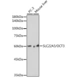 Western Blot - Anti-SLC22A3/OCT3 Antibody [ARC2285] (A305965) - Antibodies.com