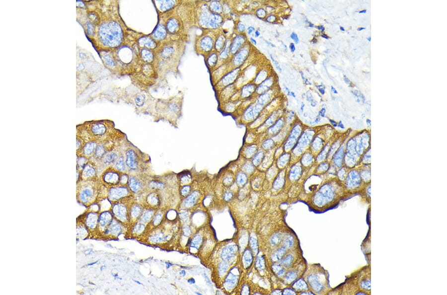 Immunohistochemistry - Anti-SLC22A3/OCT3 Antibody [ARC2285] (A305965) - Antibodies.com
