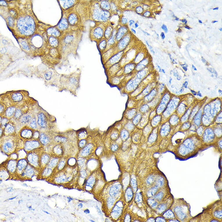 Immunohistochemistry - Anti-SLC22A3/OCT3 Antibody [ARC2285] (A305965) - Antibodies.com