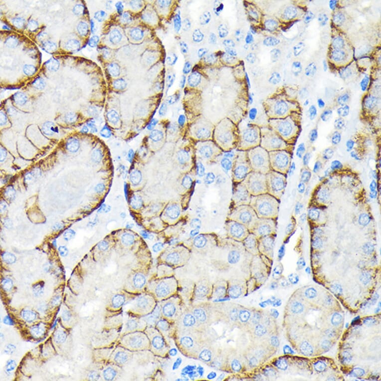 Immunohistochemistry - Anti-SLC22A3/OCT3 Antibody [ARC2285] (A305965) - Antibodies.com