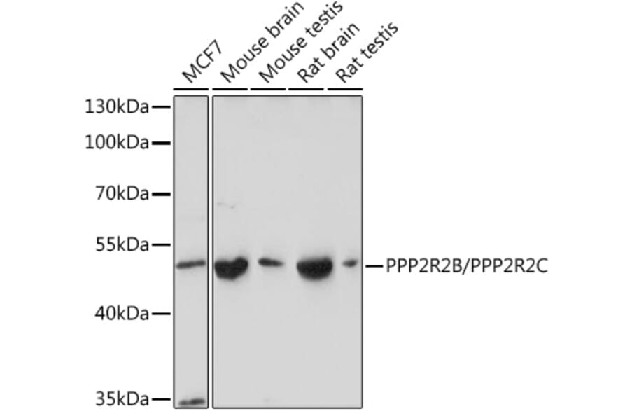 Western Blot - Anti-PPP2R2B + PPP2R2C Antibody (A305966) - Antibodies.com