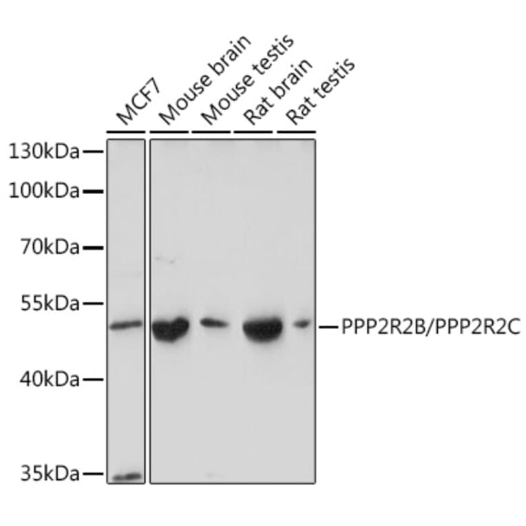 Western Blot - Anti-PPP2R2B + PPP2R2C Antibody (A305966) - Antibodies.com