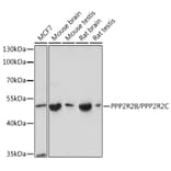 Western Blot - Anti-PPP2R2B + PPP2R2C Antibody (A305966) - Antibodies.com