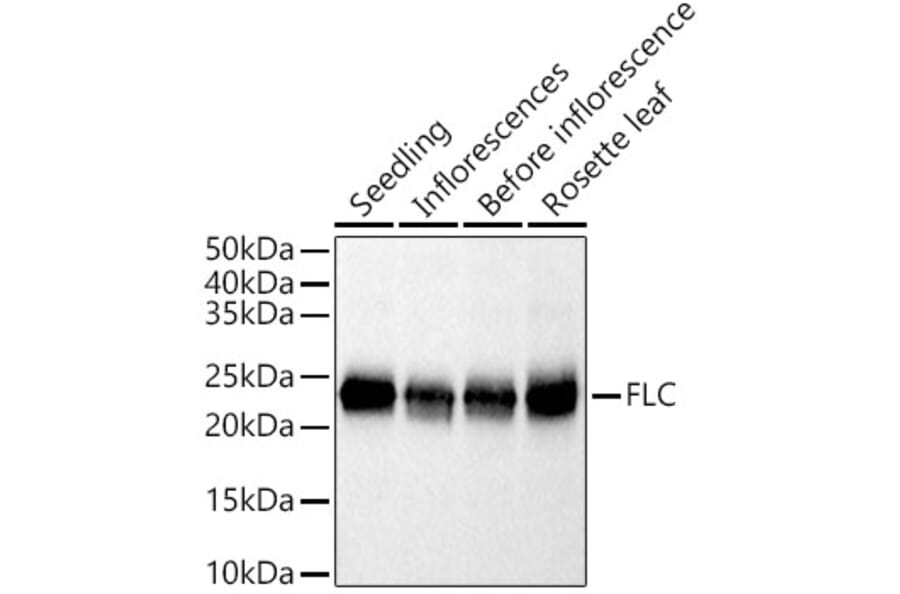 Western Blot - Anti-FLC Antibody (A305967) - Antibodies.com