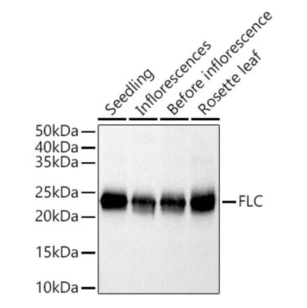 Western Blot - Anti-FLC Antibody (A305967) - Antibodies.com